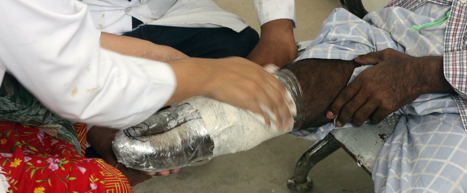 Artificial limb is fitted to a patient at Healthcare and Social Welfare Association, Karachi